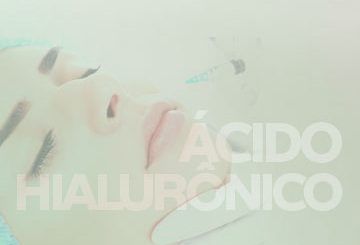Preenchimento facial com ácido hialurônico